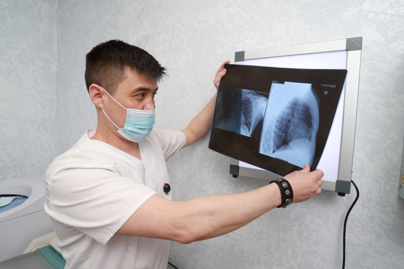 «Я здоров! Туберкулеза нет»: проверить свои легкие приглашают жителей региона в поликлиниках НСО
