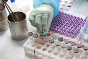 Системы непрерывного мониторинга глюкозы для тысячи детей с диабетом предоставили в Новосибирске