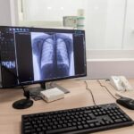 Врачи отмечают рост числа случаев рака легкого среди женщин в Новосибирской области