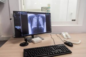 Врачи отмечают рост числа случаев рака легкого среди женщин в Новосибирской области