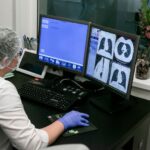 Смертность от туберкулёза в Новосибирской области уменьшилась на 36 процентов