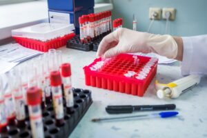 Александр Жуков сообщил о дополнительных средствах на датчики для новосибирских диабетиков